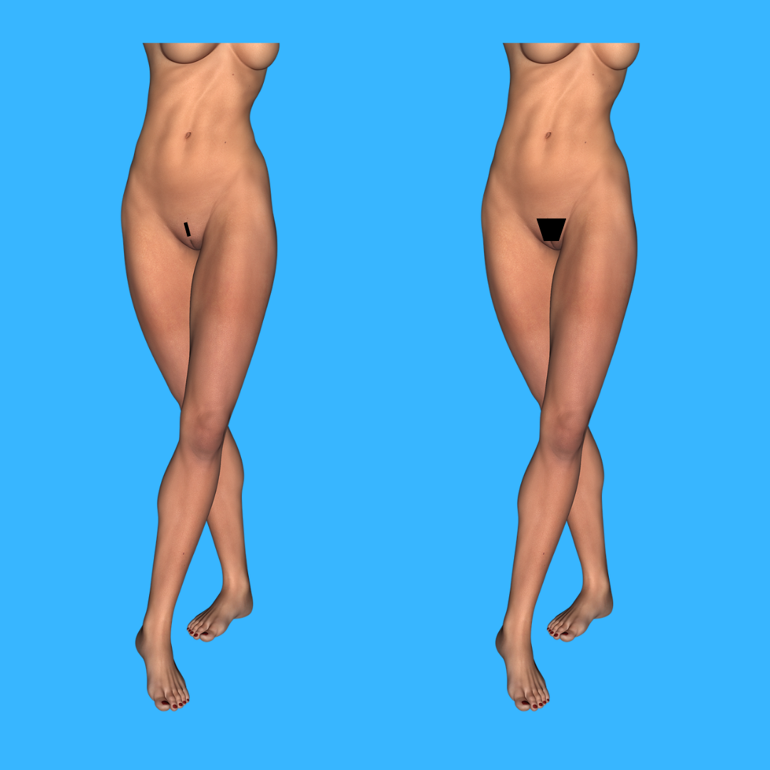 diseño de vello pubico para mujeres en ciudad de panama