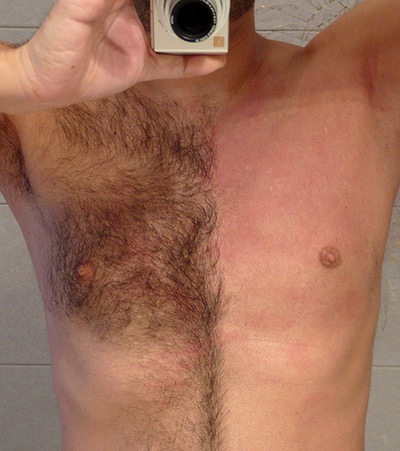 rebaja y recorte de vello corporal para varones ciudad de panama